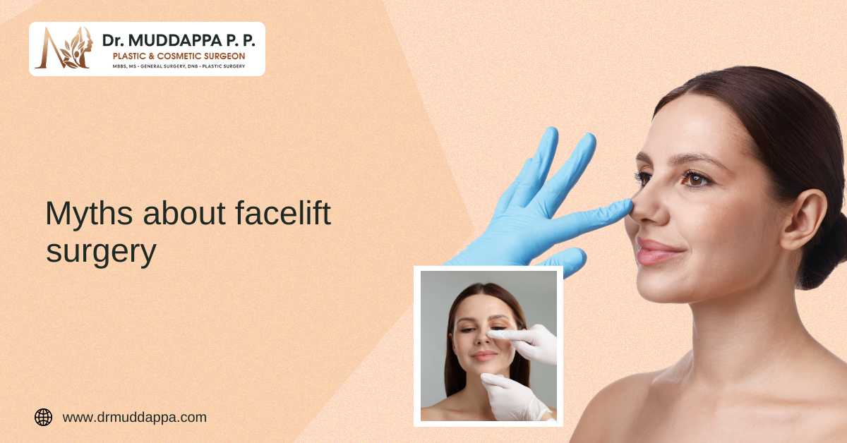 Myths about Facelift Surgery
