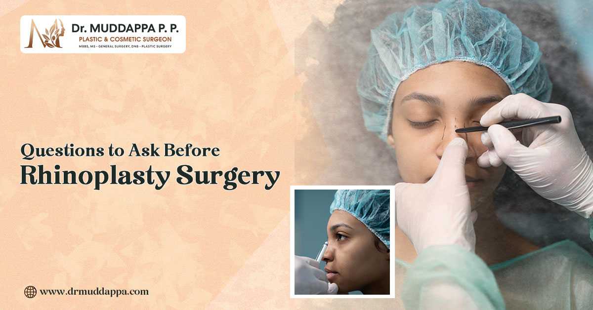 Questions to Ask Before Rhinoplasty Surgery