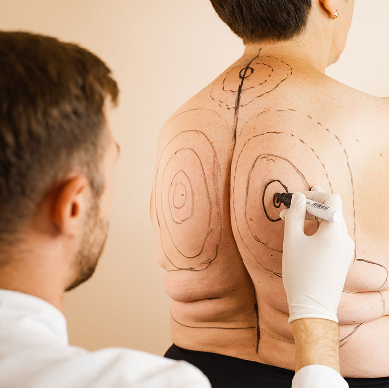 breast enlargement