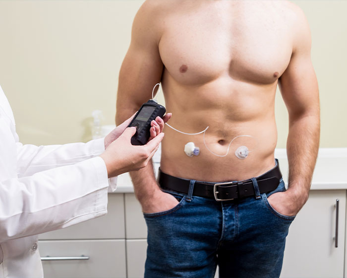 Gynecomastia surgery
