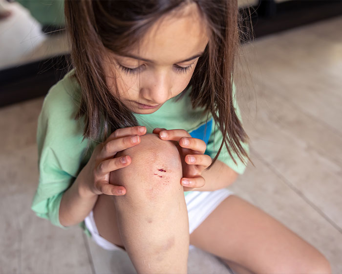 Minor cuts