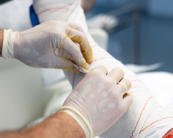 Reconstructive Surgery