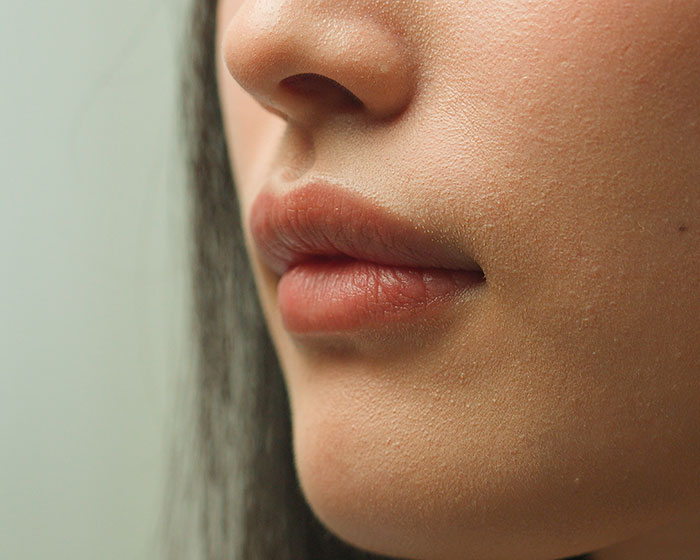 Lip Reduction Surgery