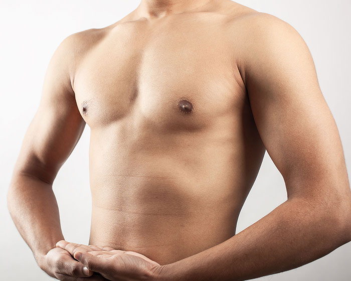 Gynaecomastia Surgery