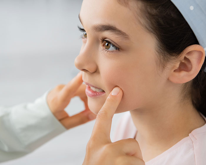 Cleft Lip and Palate Surgery