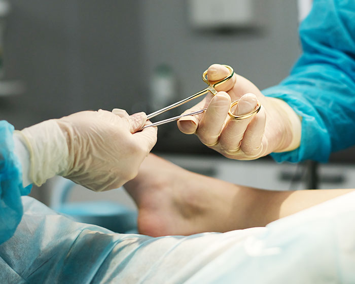 Diabetic Foot Surgery