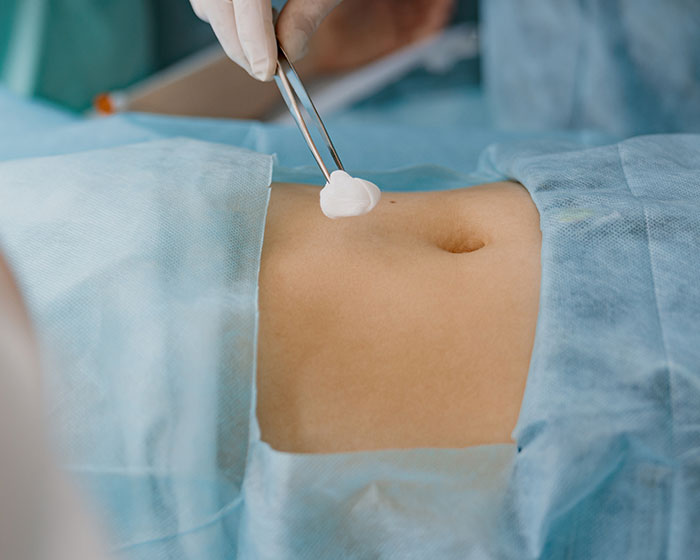 Complex Abdominal Hernia Repairs