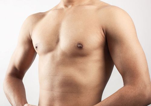 Gynaecomastia surgery